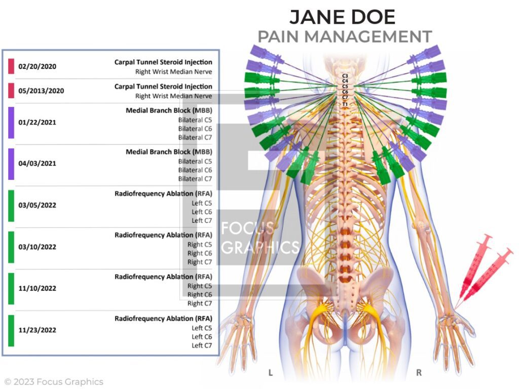 Pain Management Summary showing dates and treatments