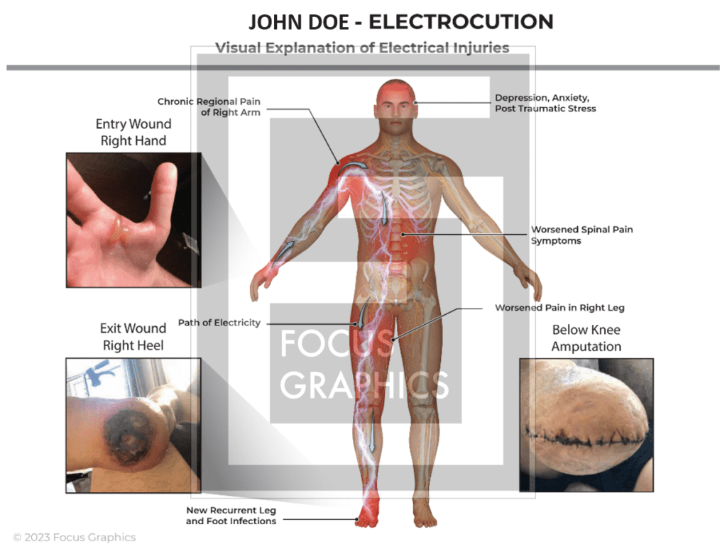 diagram showing path of electricity through body