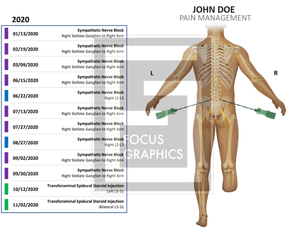 Summary showing injections for pain over a period of time
