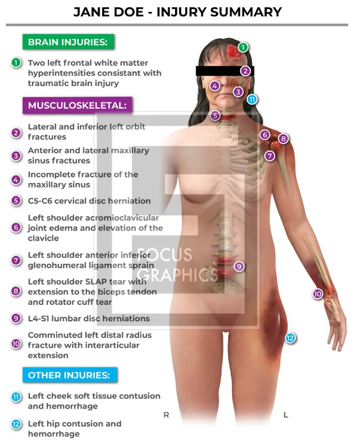 Injury summary from a slip and fall