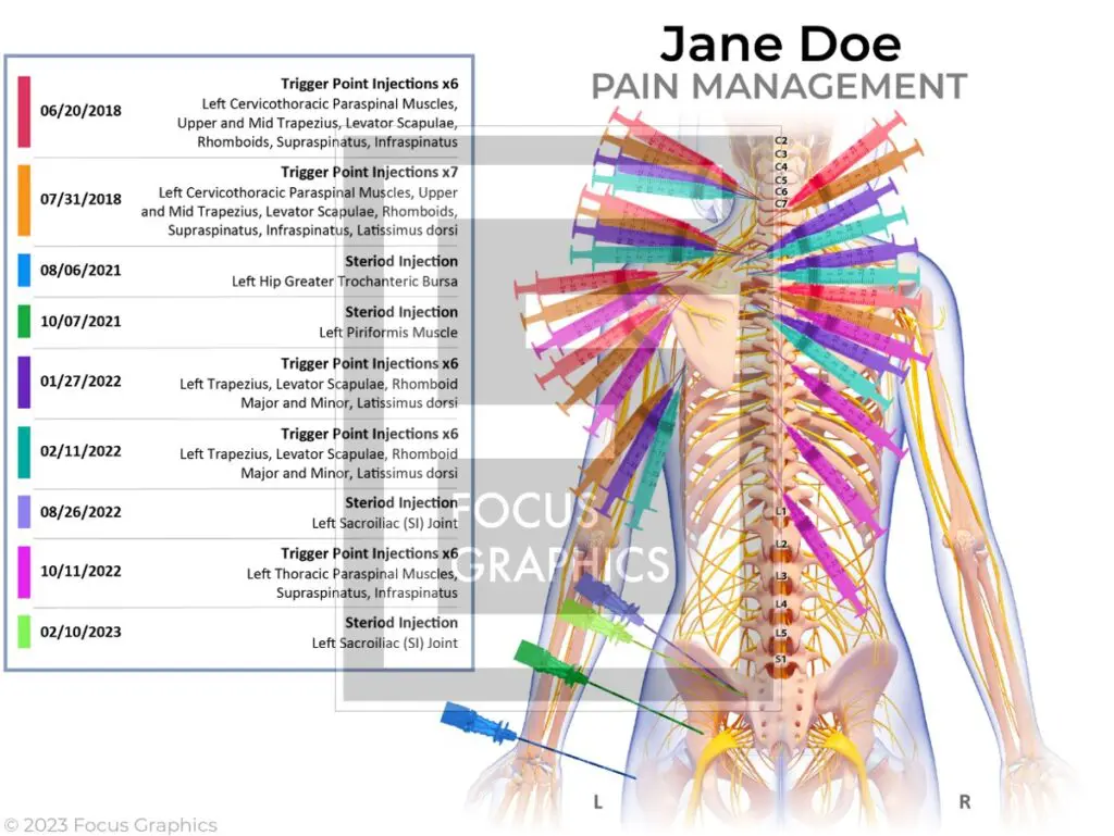 Pain management summary