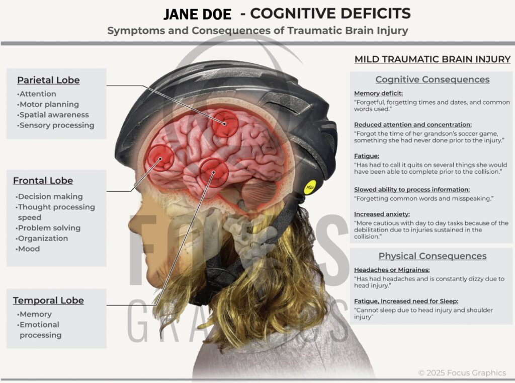 Image showing how injury to different parts of the brain can cause different cognitive deficits
